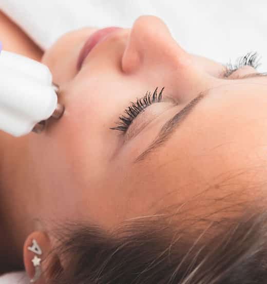 radiofrecuencia facial