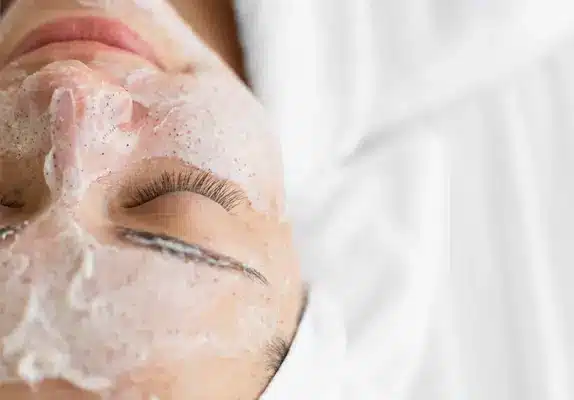 limpieza facial microdermoabrasion velo de colageno malaga