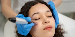 dermapen