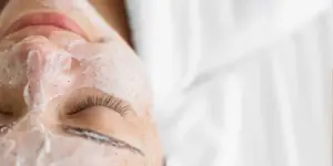 limpieza facial malaga